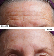 Load image into Gallery viewer, Silc Skin Brow Pad Set for Wrinkles
