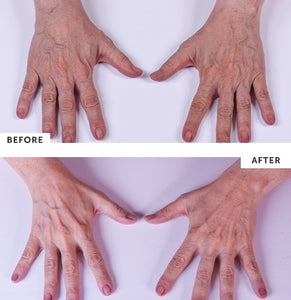 Silc Skin Hand Treatment