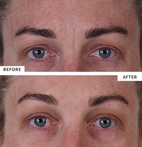 Silc Skin Full Face Set for Wrinkles